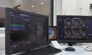 Xơ cứng rải rác - bệnh gây mờ mắt, tê yếu tay chân